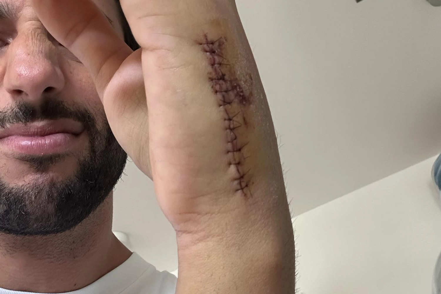 In convalescence, Daniel Ricciardo is still present in Singapore